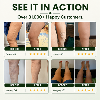 Sevrica Miracle balm